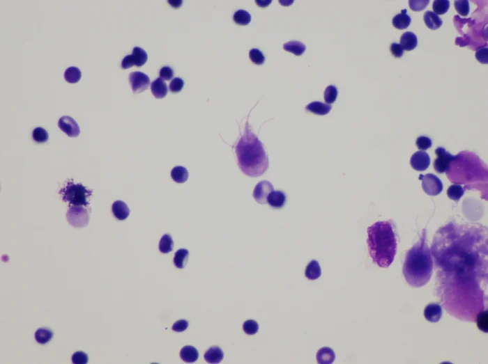 What Is The Parasite That Makes You Love Cats And Is It Real