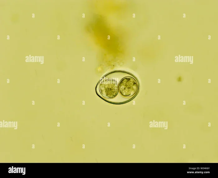 What Is The Parasite That Makes You Love Cats And Is It Real