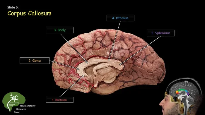 What Connects The Two Hemispheres Of The Brain Explained