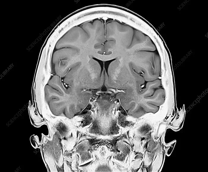 Where Is The Hypothalamus Located In The Human Brain