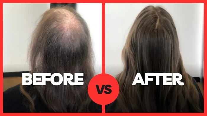 Dream Of Losing Hair Meaning What Your Subconscious Is Telling You