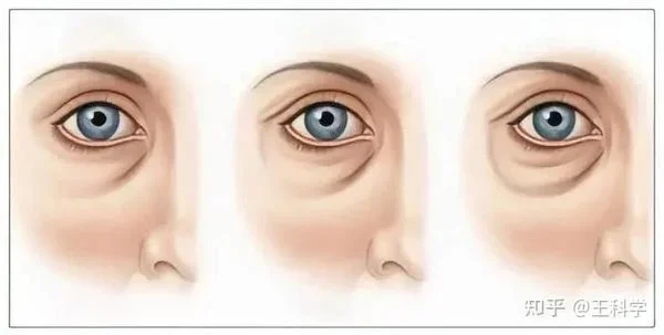 Stolkholm Syndrome Without Dating