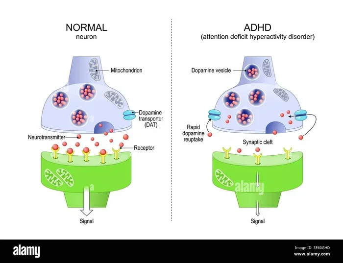 How Hormones Shape The Female Adhd Experience Explained