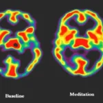 Holzel Et Al Mindfulness And Brain Scans You Need To Know