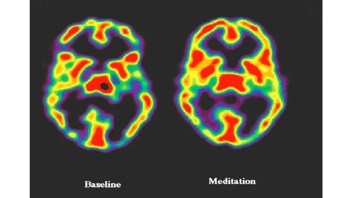 Holzel Et Al Mindfulness And Brain Scans You Need To Know